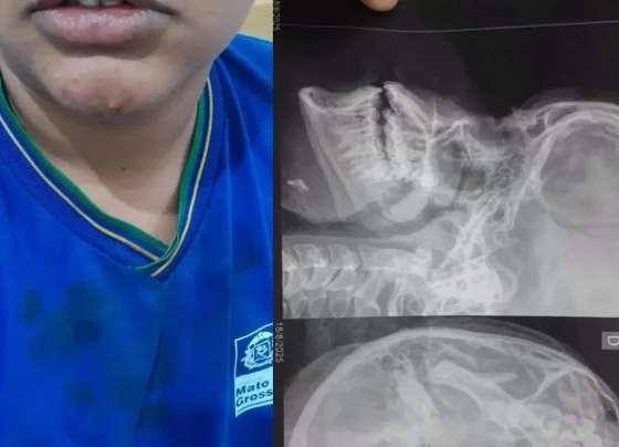 Adolescente é brutalmente agredida por colegas dentro de escola estadual em Alto Araguaia. (Foto: Reprodução)